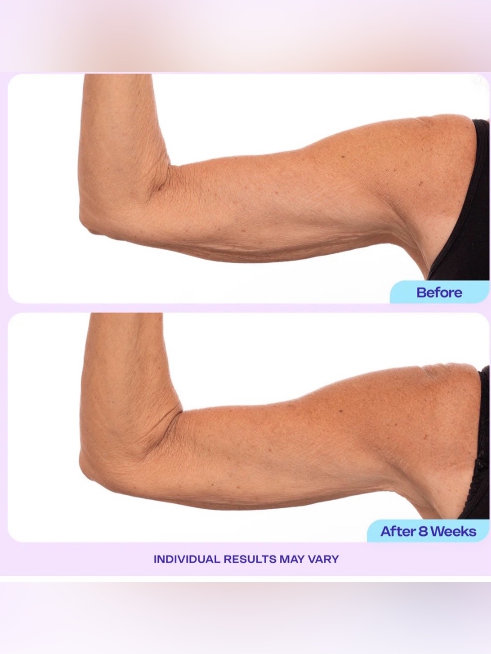 GOPURE Sculpt & Tone Arm Cream - Picture 2 of 13